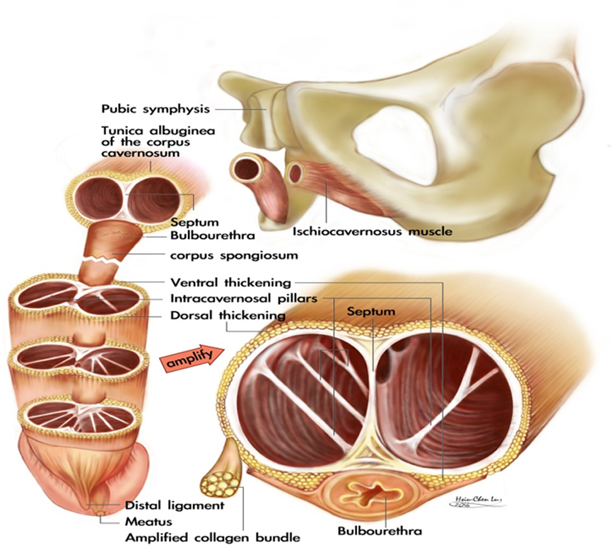 陰莖“白膜”的構造 描繪圖